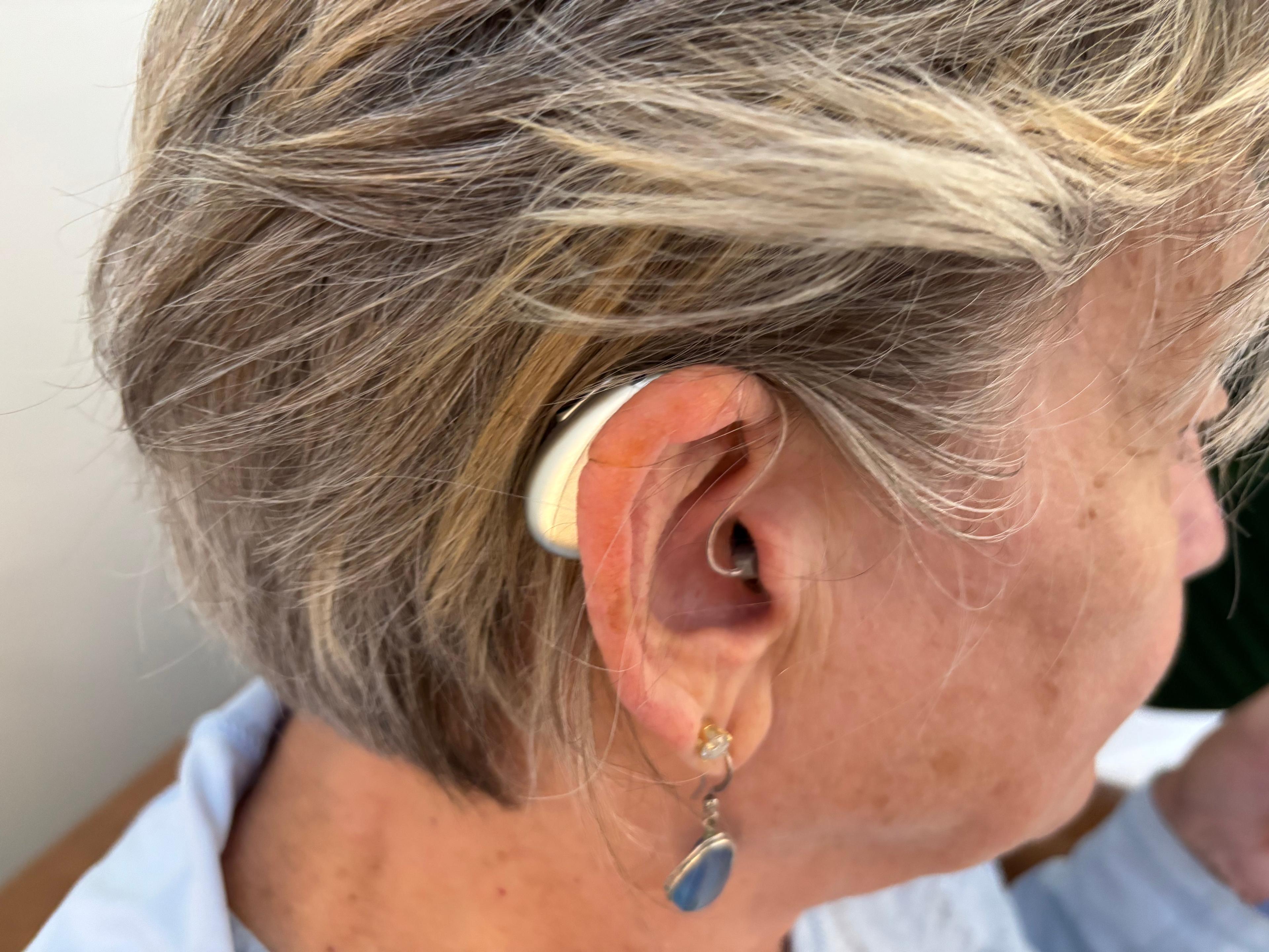 A woman wears the Elehear Beyond Pro Hearing Aids