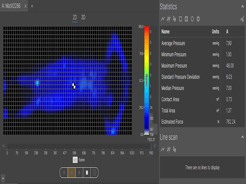 Thermal imaging from a pressure map lights up blue to show good pressure relief