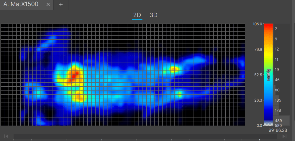 A pressure map image showing blue, red, orange, and yellow
