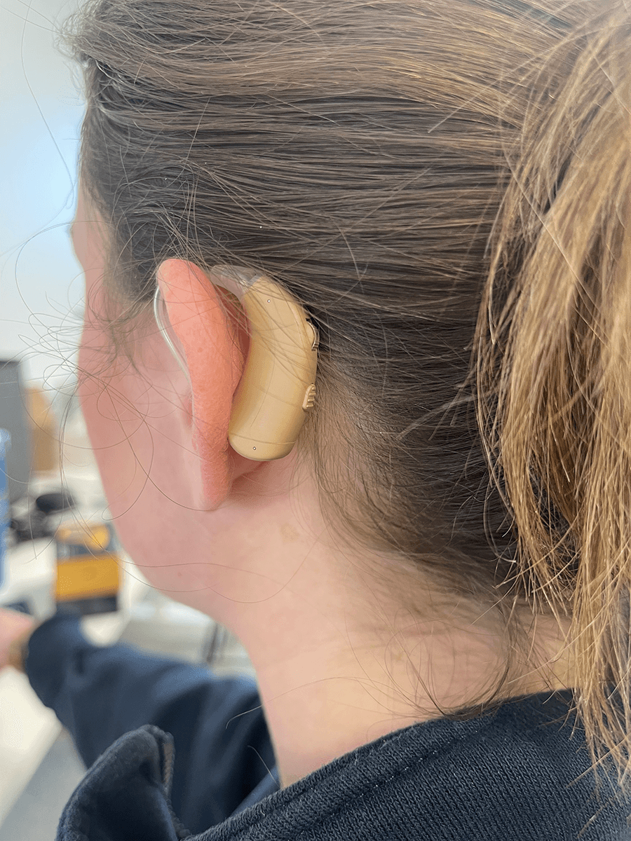 A woman with the MDHearing Volt hearing aid on her ear