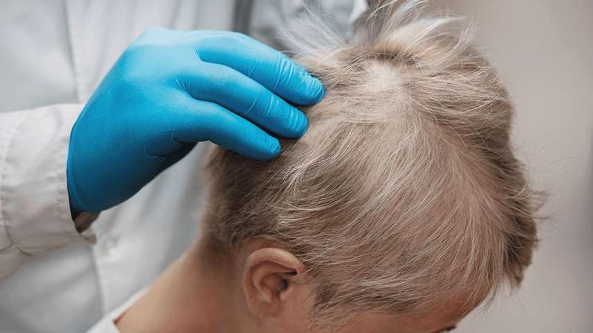 gloved hands of doctor examining woman's thinning scalp