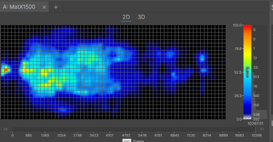 A pressure map for the Helix Midnight Luxe mattress.