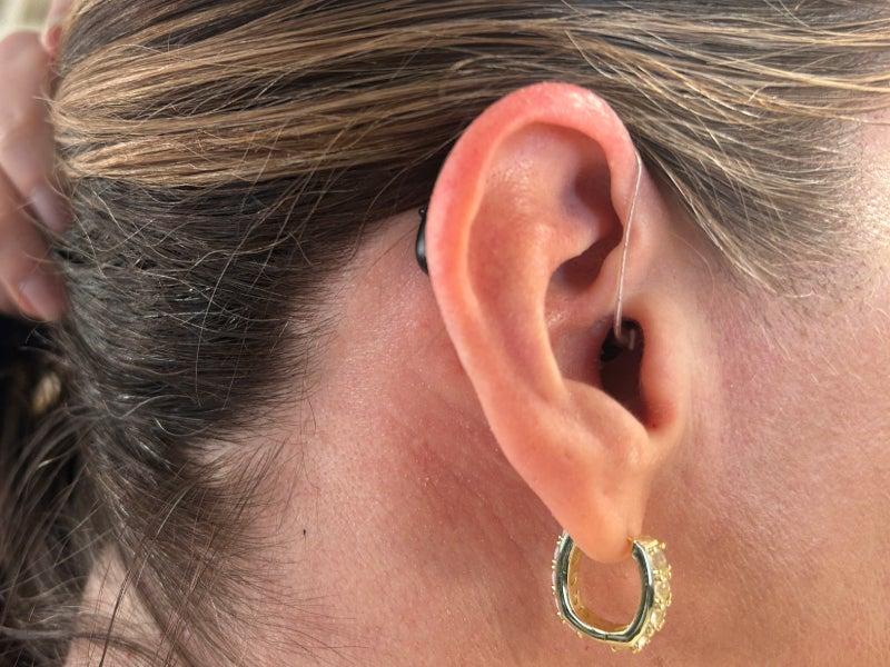 A close up picture of a woman's ear wearing Signia hearing aids