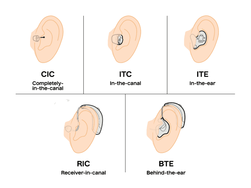 An image showing 5 different types of hearing aids and how they fit in the ear