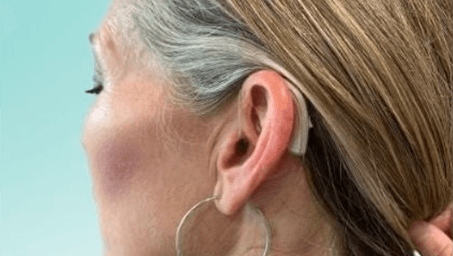 hearing aid behind a woman's ear