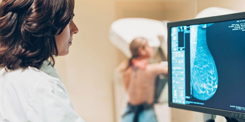Breast cancer is highly treatable if found in the early stages when treatment is more likely to be successful. Learn how screenings can be effective for early detection.